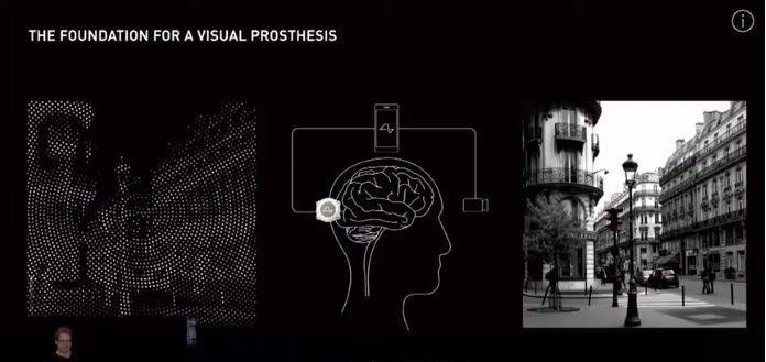 全球科技早参丨Neuralink首次将芯片植入人类大脑